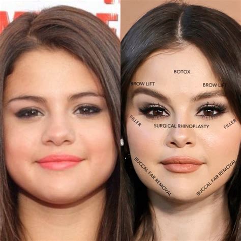 selena gomez boobs before and after|Selena Gomez Plastic Surgery Revealed! Before and After